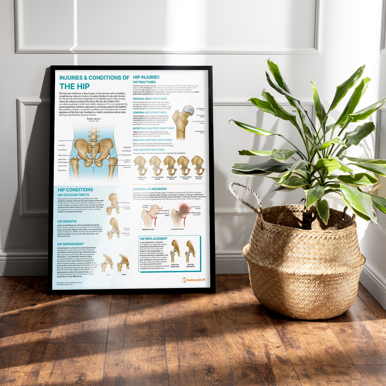 Injuries & Conditions of the Hip Chart / Poster