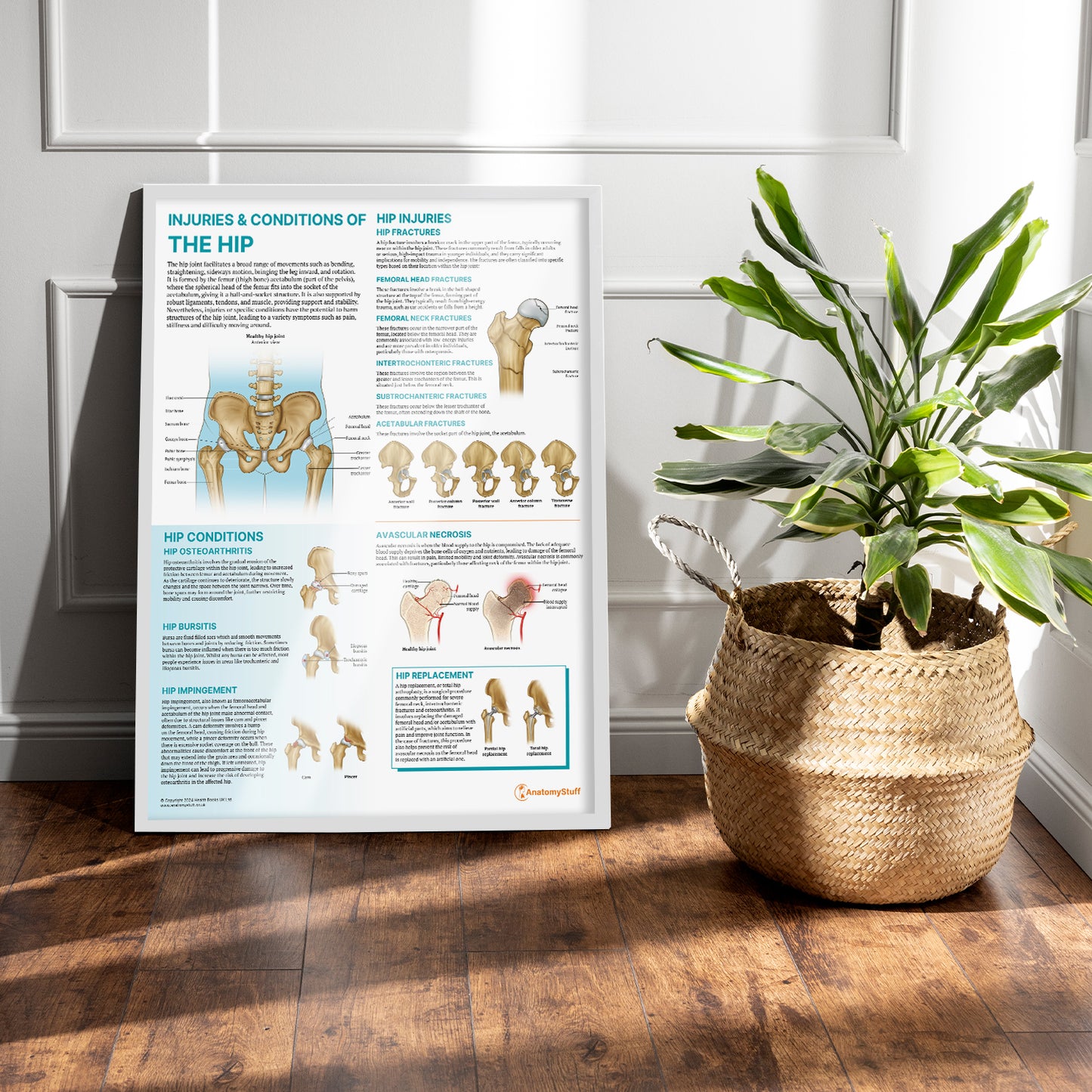 Injuries & Conditions of the Hip Chart / Poster