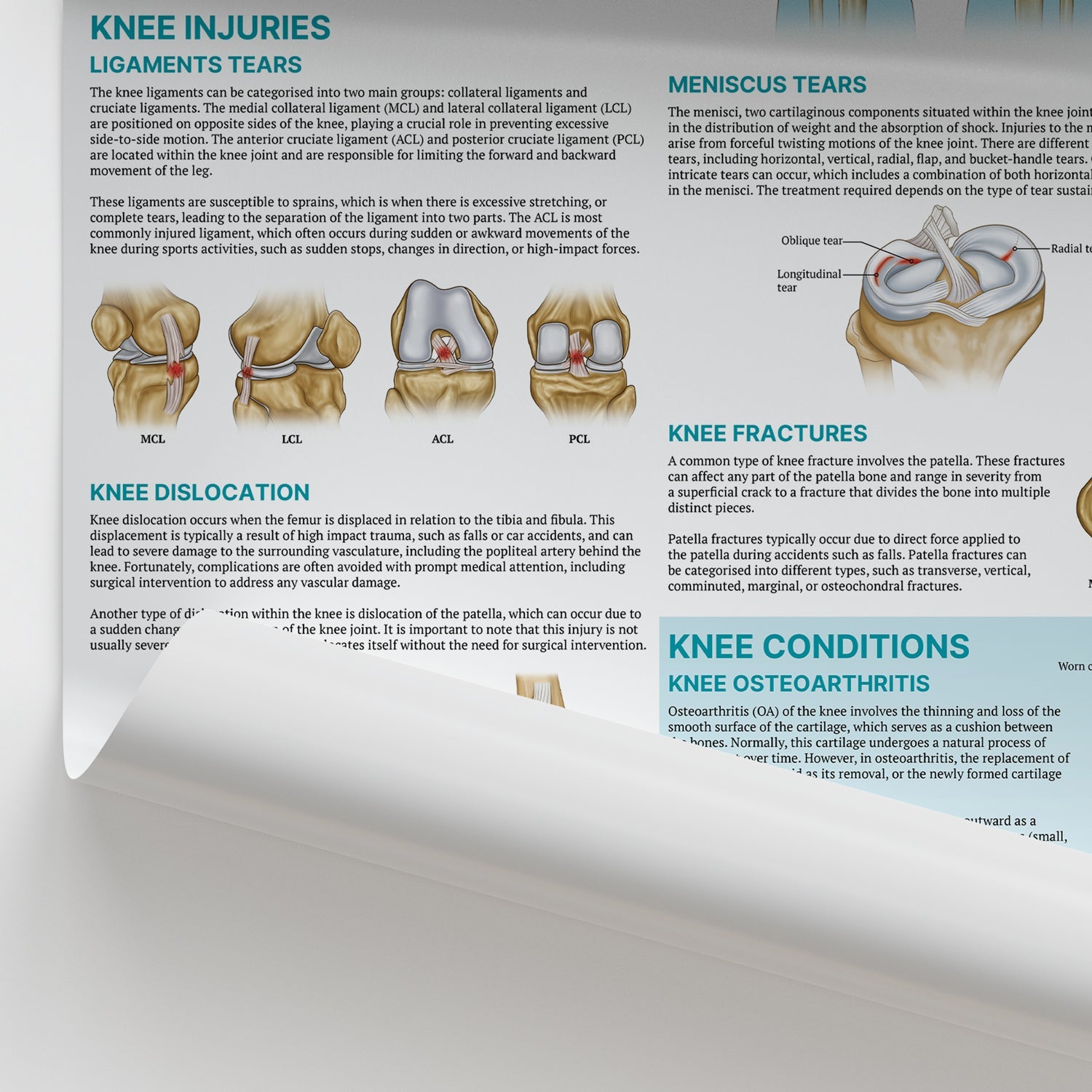 Injuries & Conditions of the Knee Chart / Poster - Part of Collection
