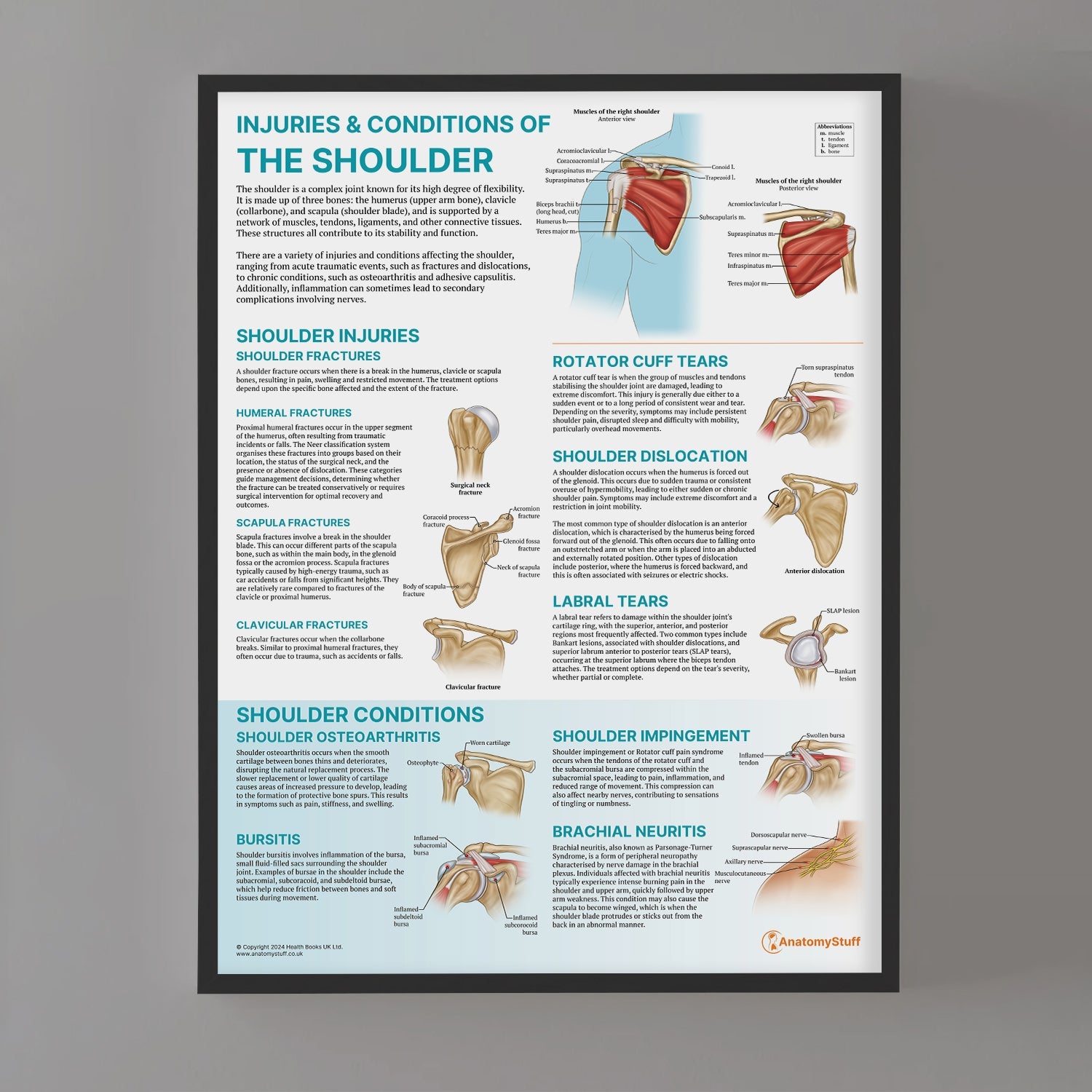 Injuries & Conditions of the Shoulder Chart / Poster - Part of Collection