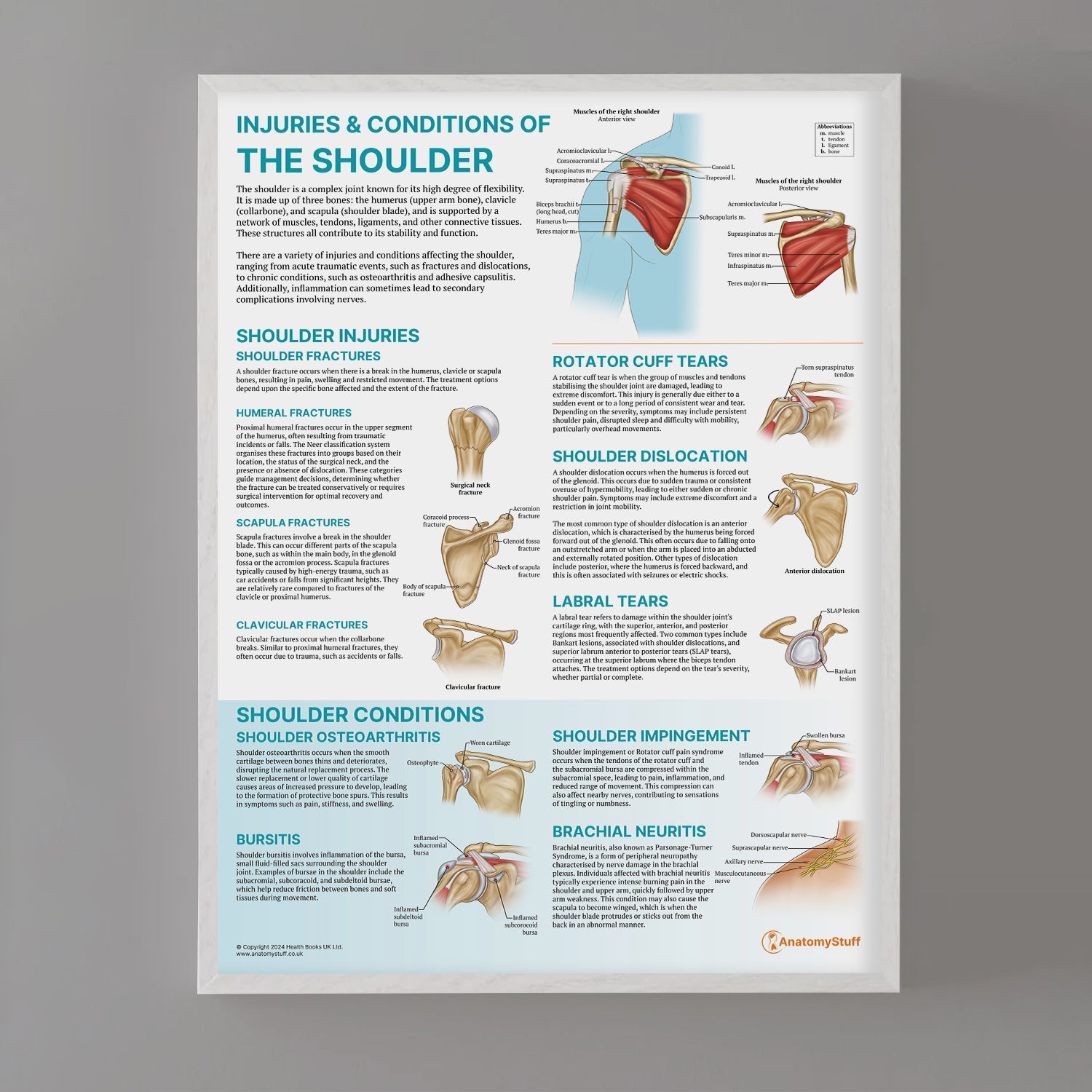 Injuries & Conditions of the Shoulder Chart / Poster - Part of Collection
