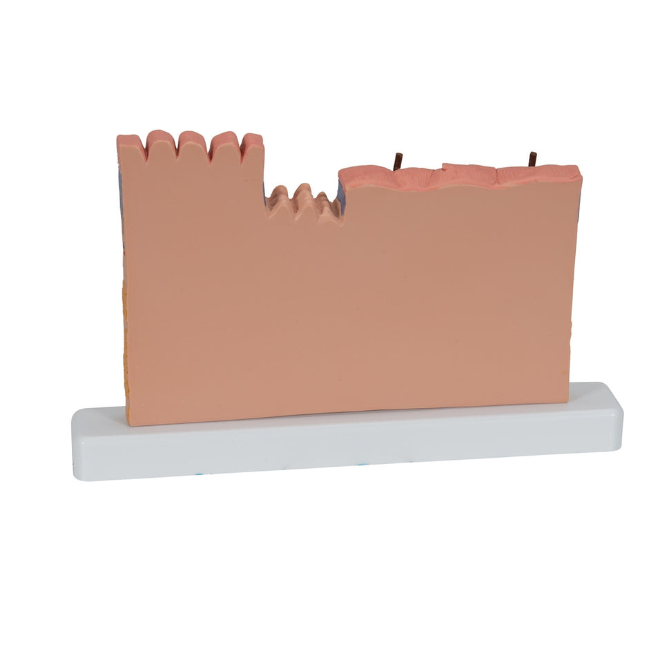 Skin Section Block Model (X 40 enlargement)