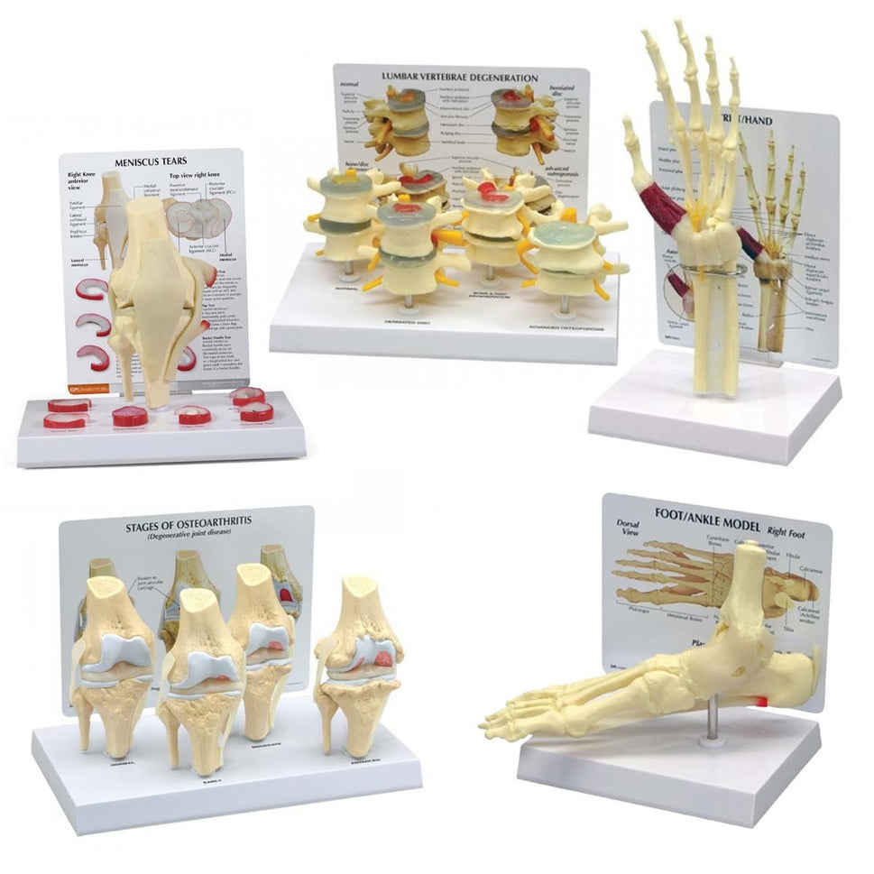 Joint Pathology Model Collection (5 part)