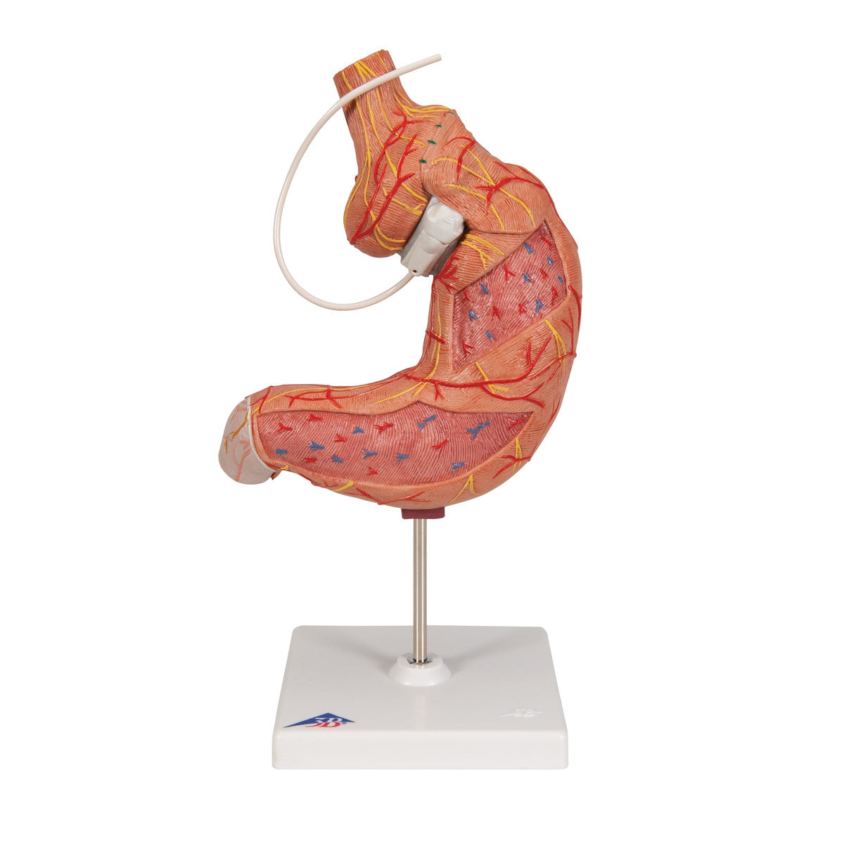 Gastric Band Model (2 part)