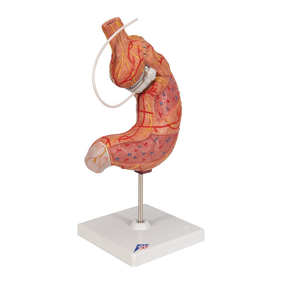 Gastric Band Model (2 part)