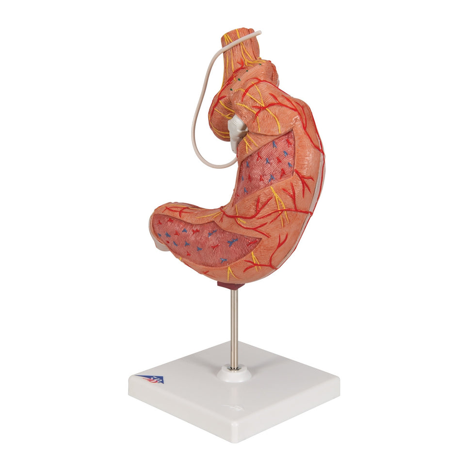 Gastric Band Model (2 part)