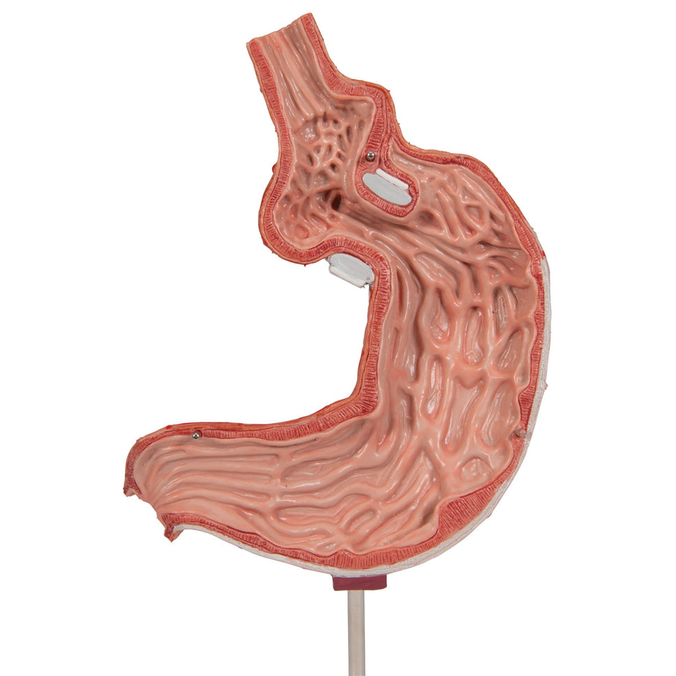 Gastric Band Model (2 part)