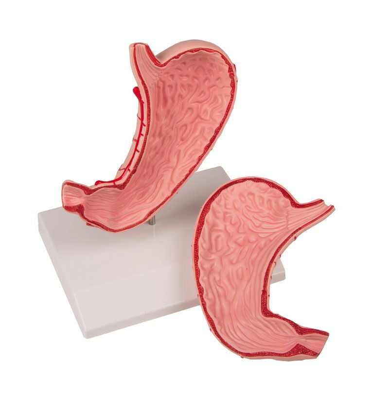 Stomach Model (Life-size, 2 part)