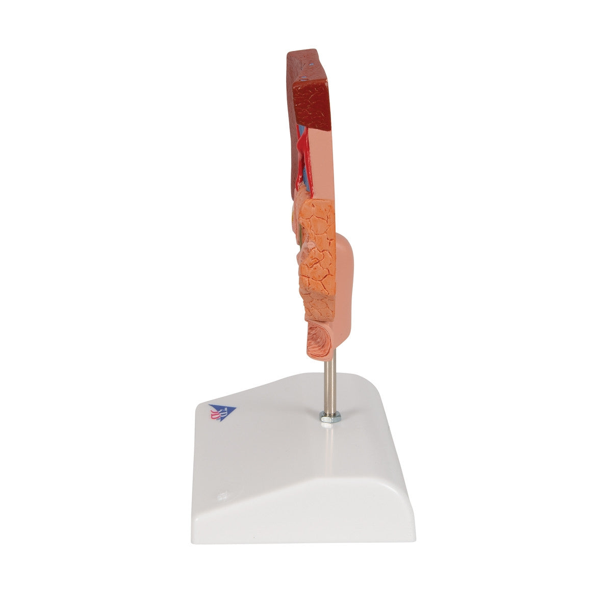 Gallstone Anatomical Model