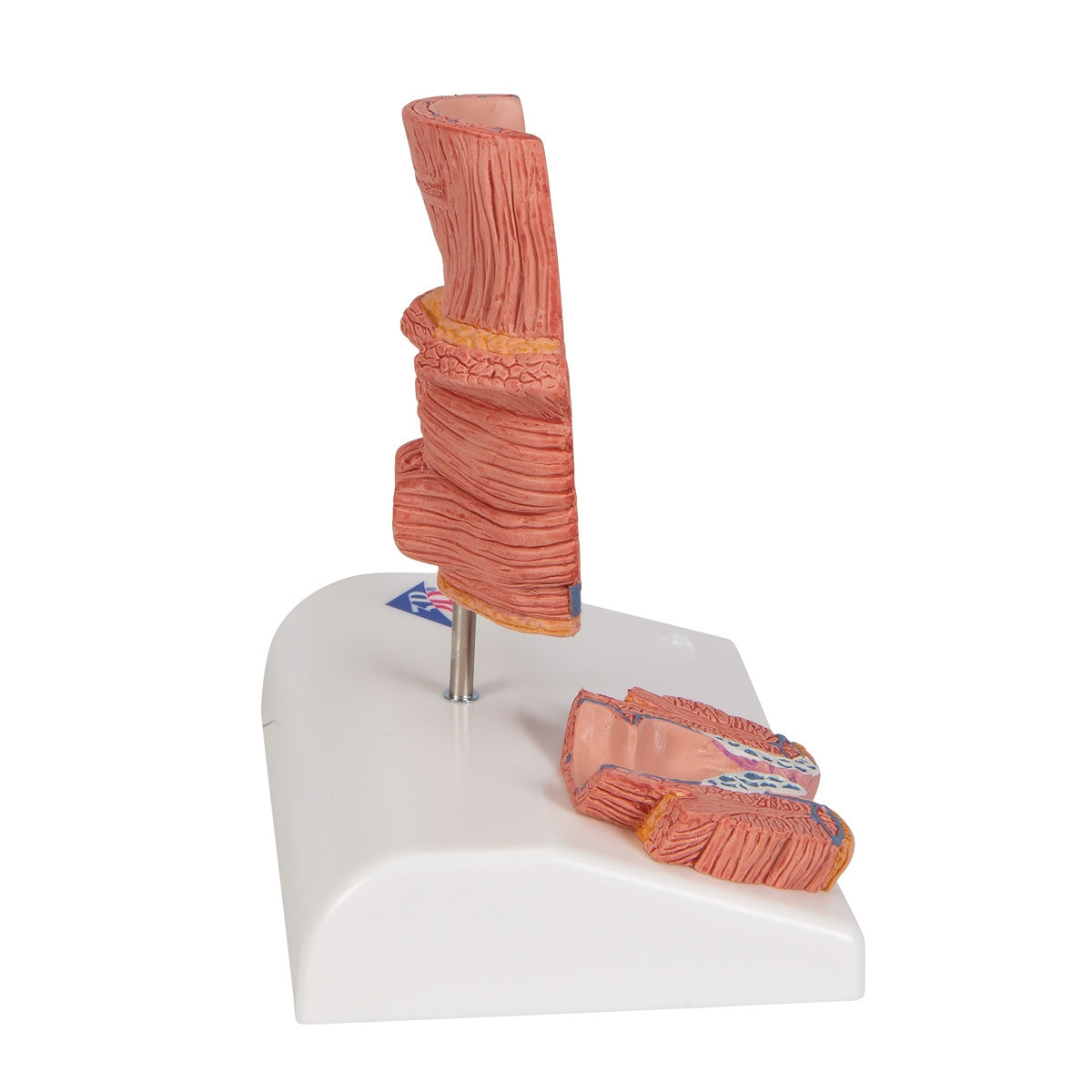 Haemorrhoid Anatomy Model