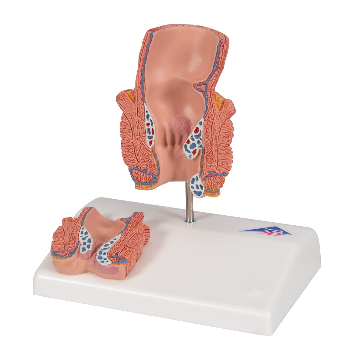 Haemorrhoid Anatomy Model
