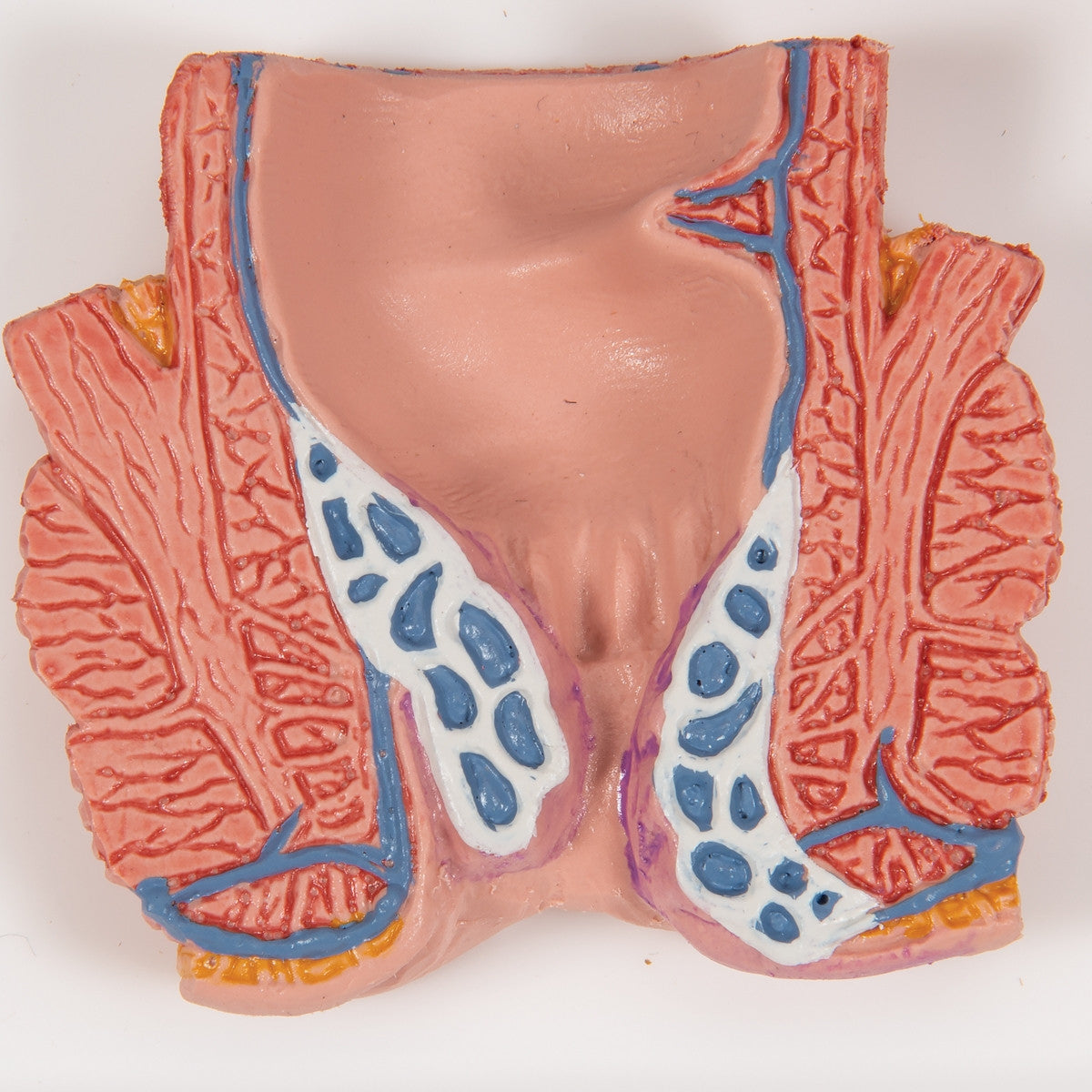 Haemorrhoid Anatomy Model