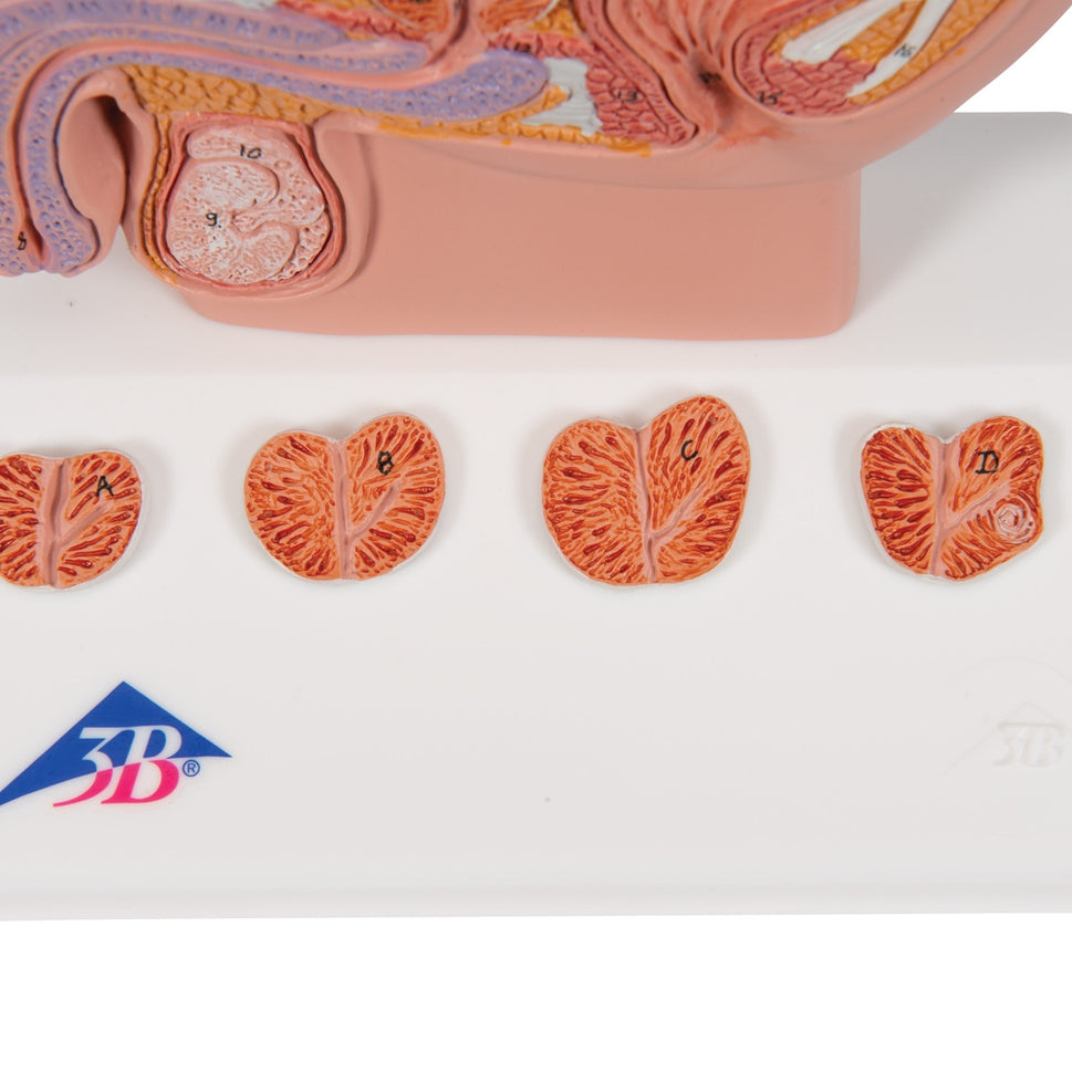 Prostate Anatomical Model