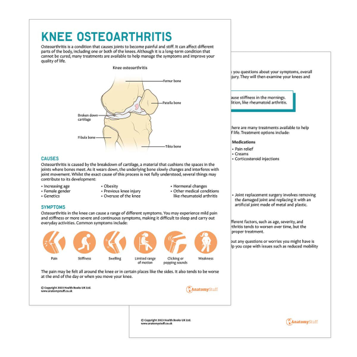 Knee Osteoarthritis Patient Education Handout (Printable PDF)