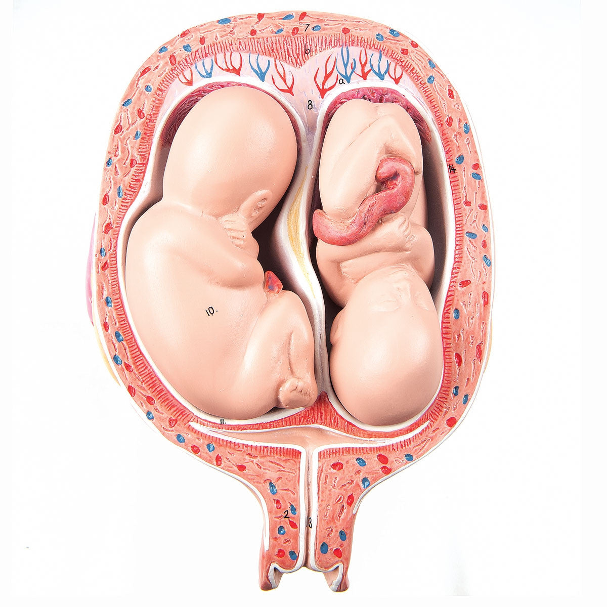5th Month Twin Foetuses Model 1000328