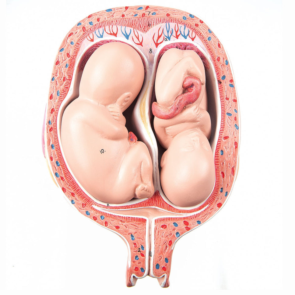 5th Month Twin Foetuses Model