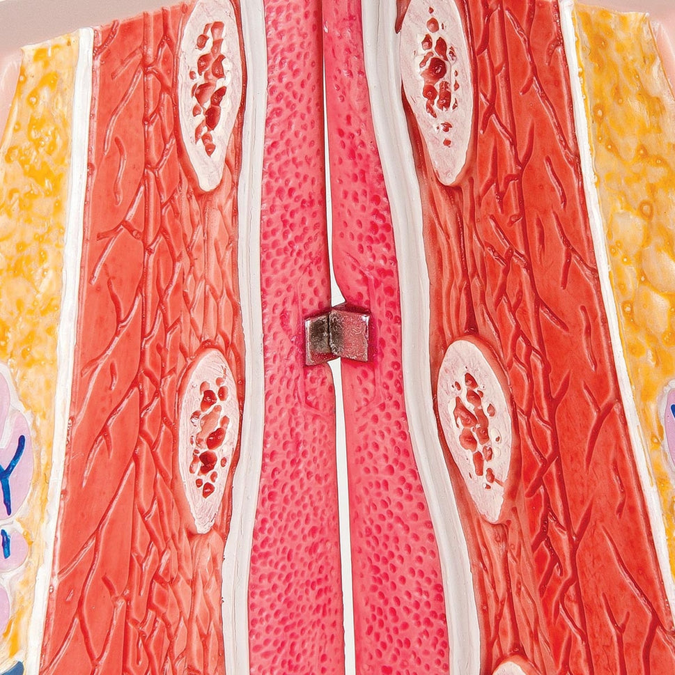 Breast Pathology Model