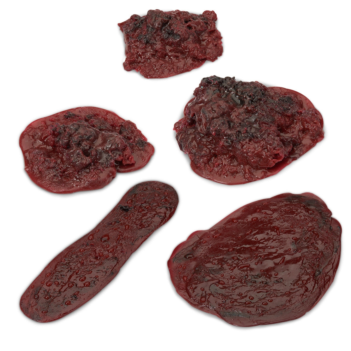 Clots and Haemorrhages (Set of 5)