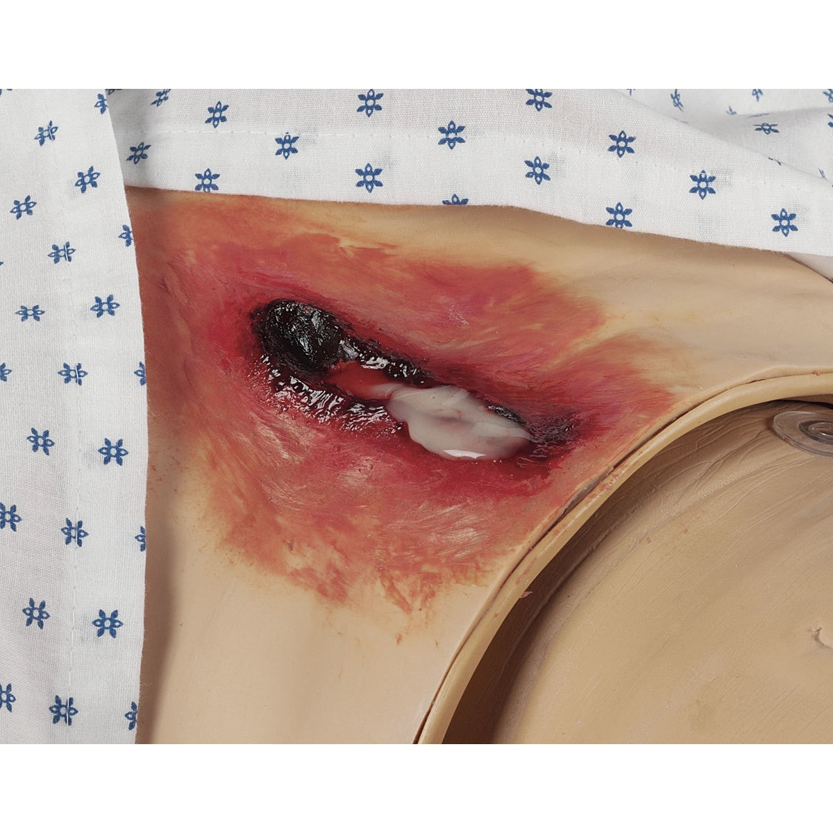 Ultra Nursing Wound Simulation Kit