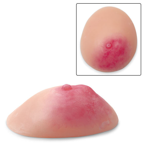 Mastitis Breast Model