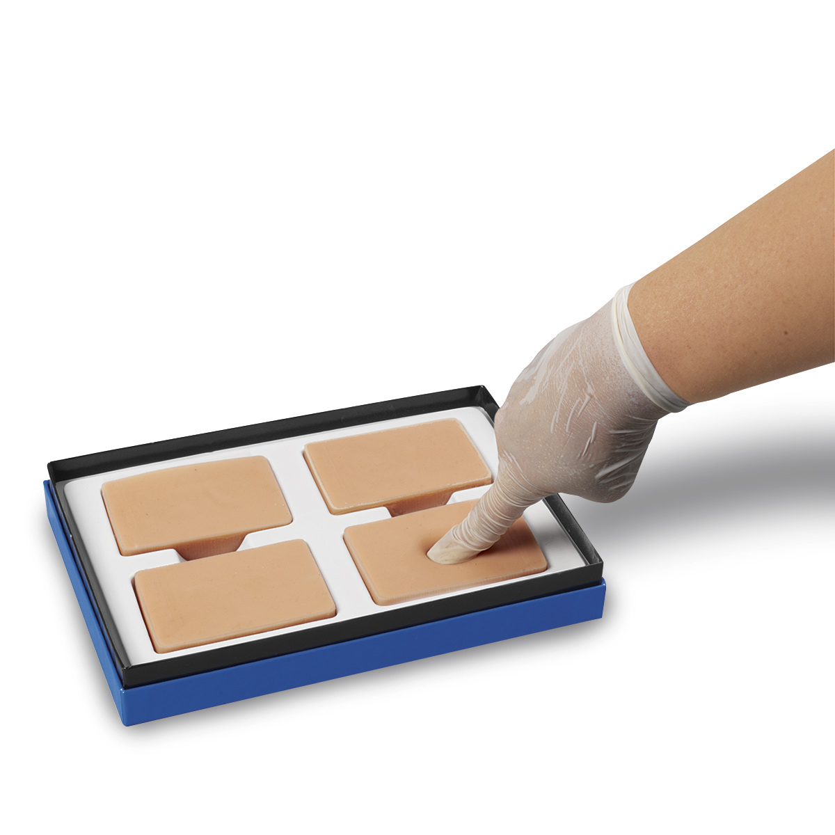 Pitting Oedema Skills Trainer (4 Stage)