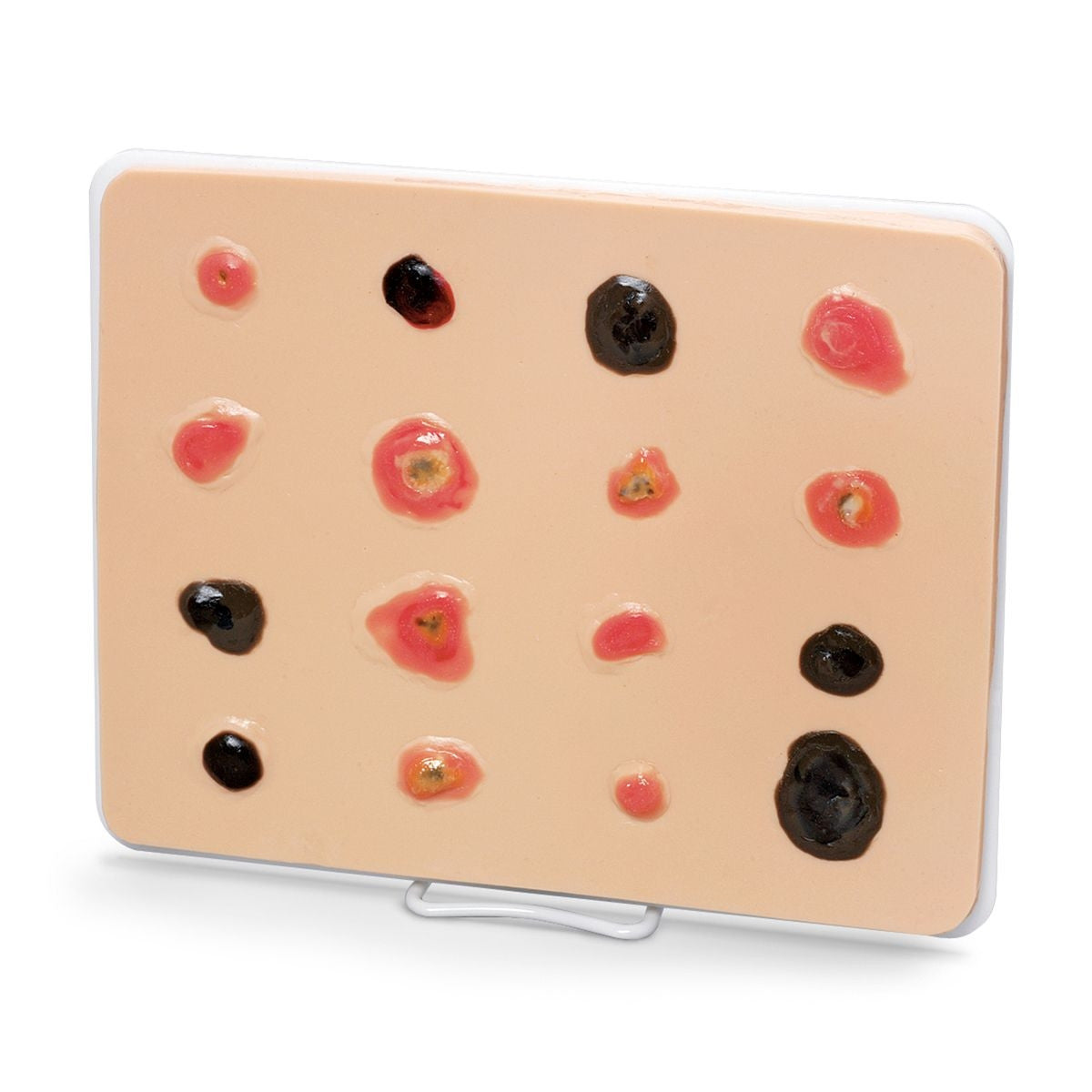 Skin Cancer Training Model