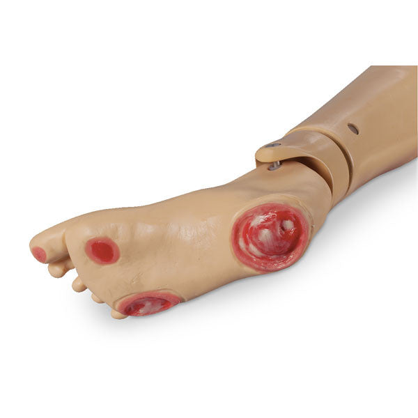 Pressure Ulcer Foot for GERi / KERi Manikins