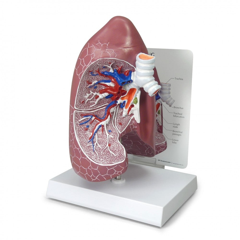 Lung Anatomy & Pathology Collection