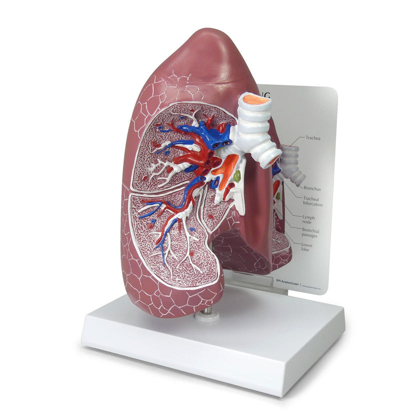 Lung Anatomy Model 3100