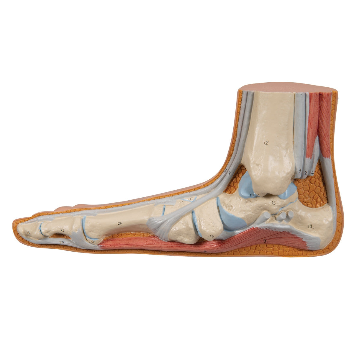 Flat Foot Model (Pes Planus)