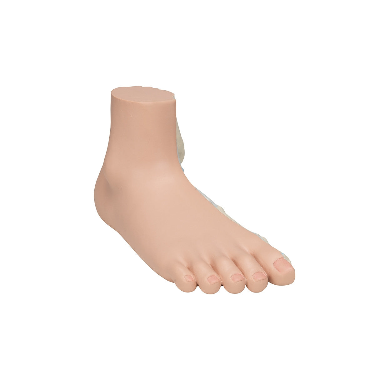 Flat Foot Model (Pes Planus)