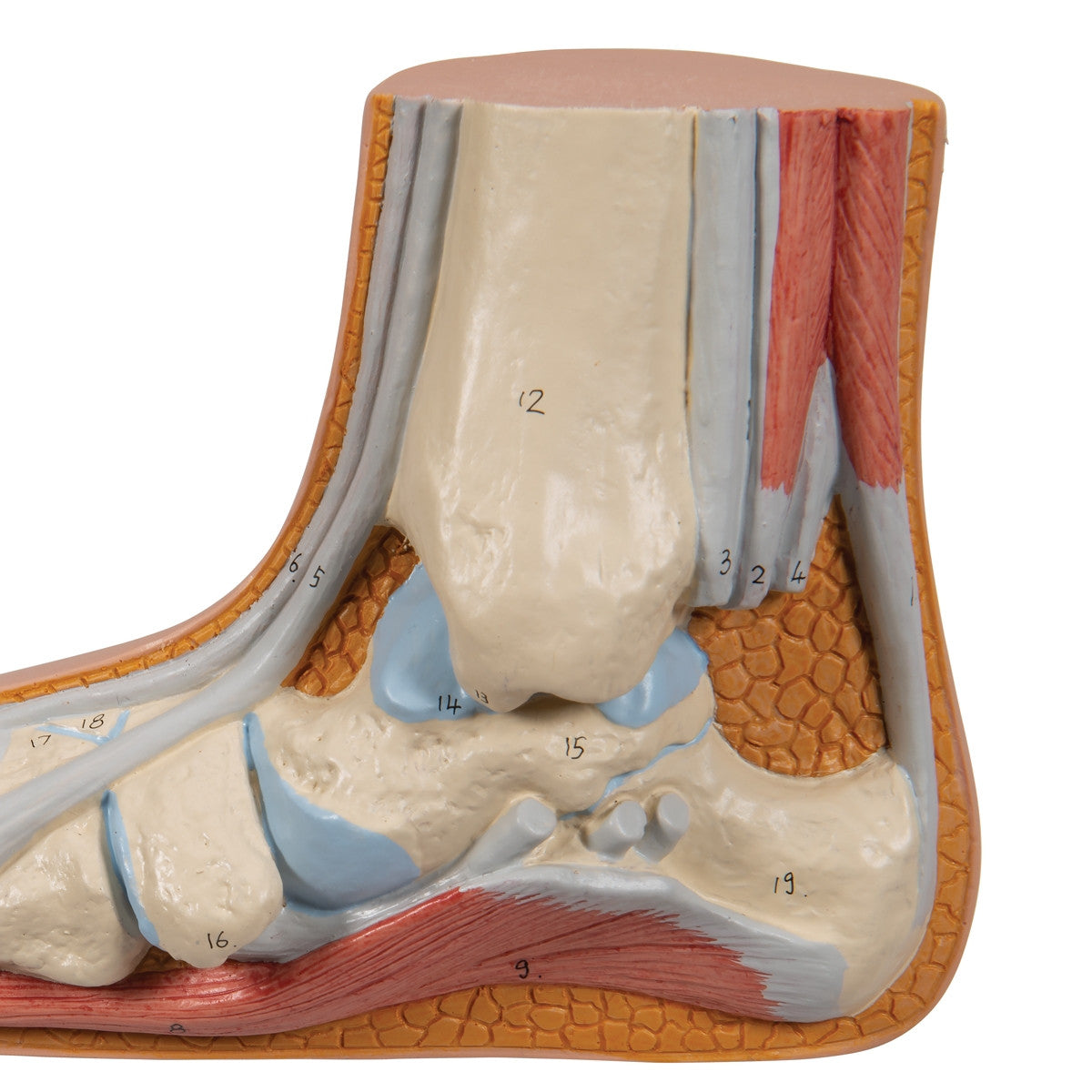 Flat Foot Model (Pes Planus)