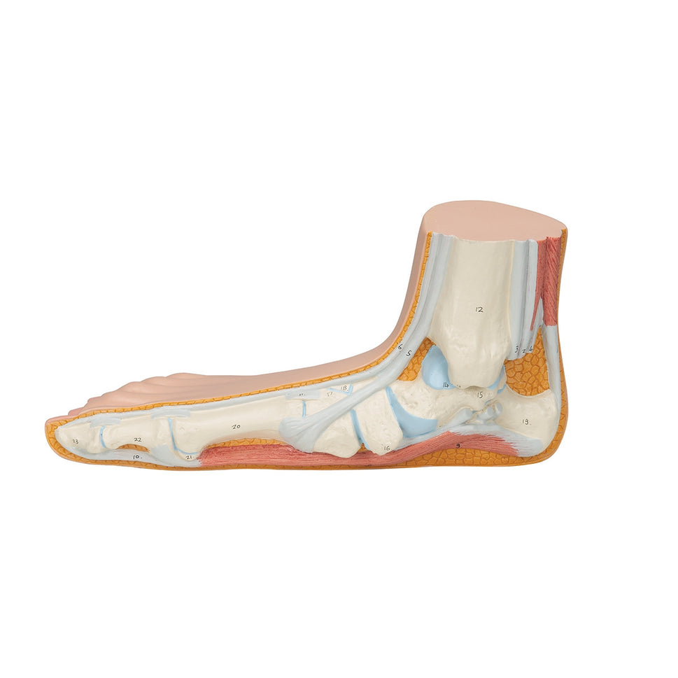 Flat Foot Model (Pes Planus)