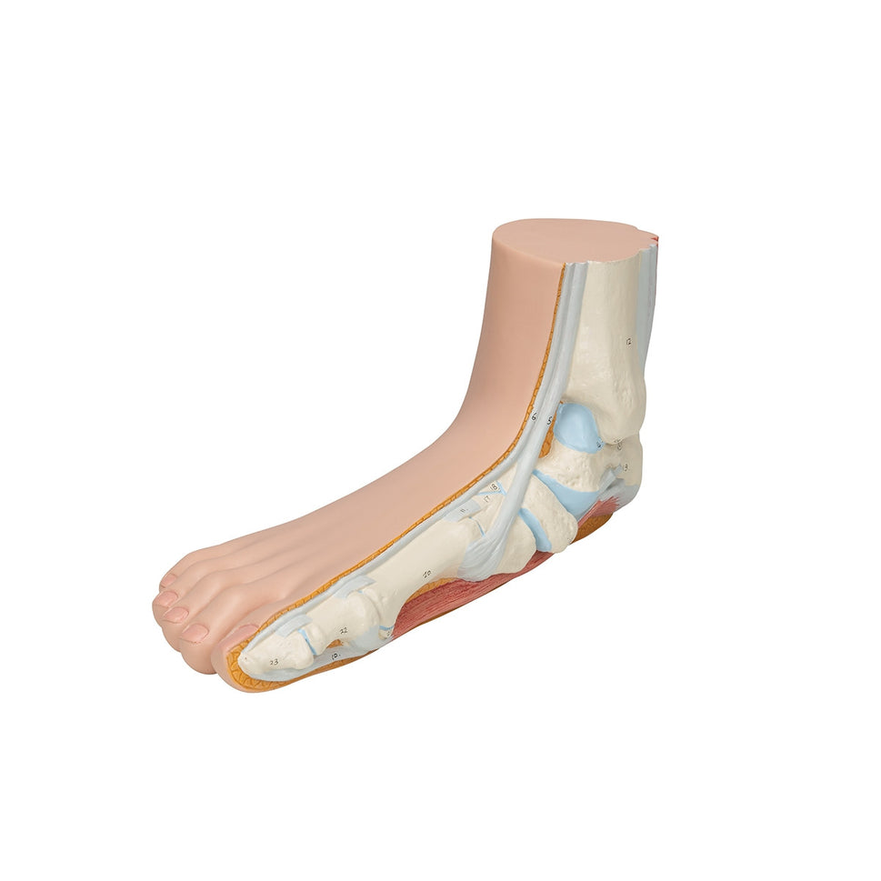 Flat Foot Model (Pes Planus)