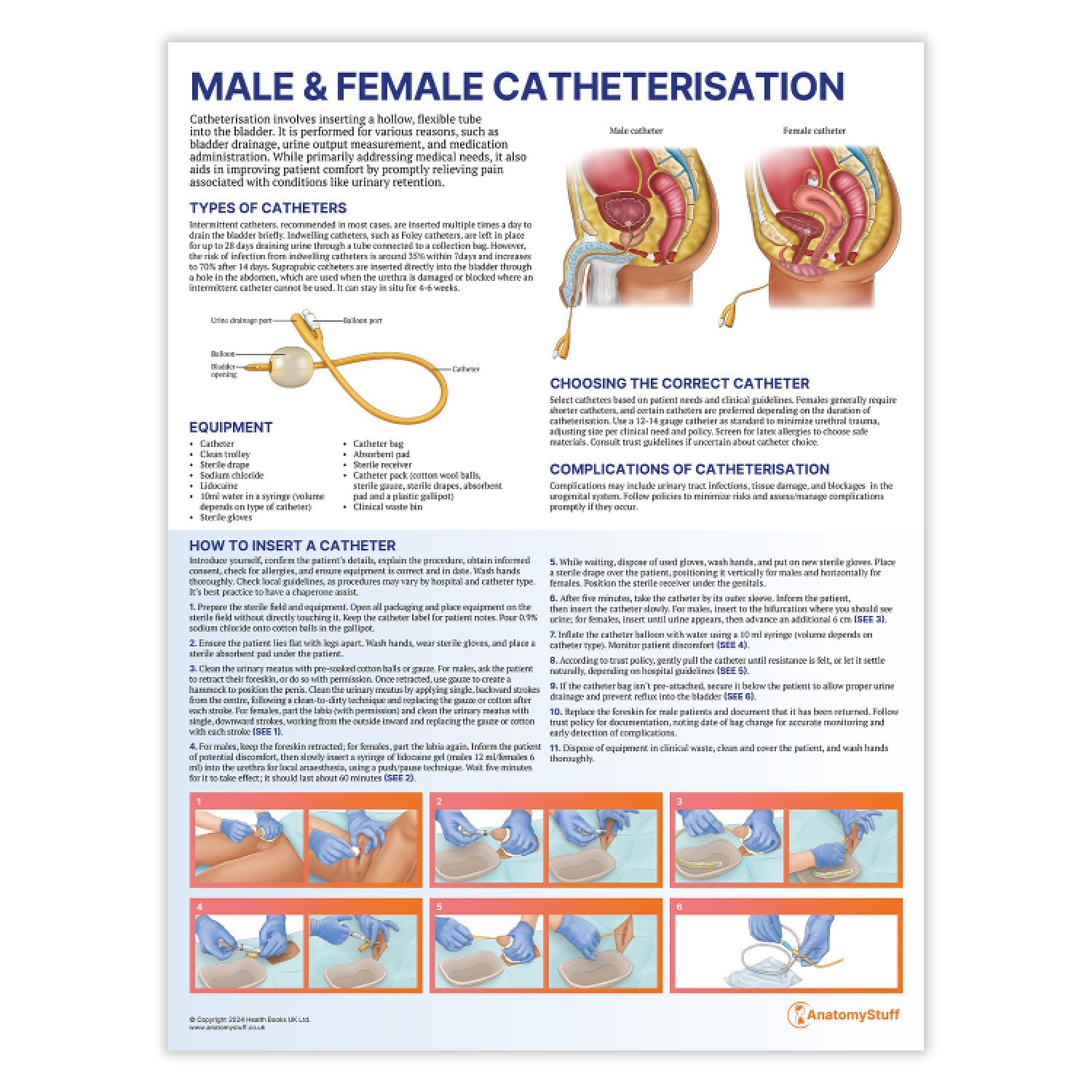 Male and Female Catheterisation Chart / Poster