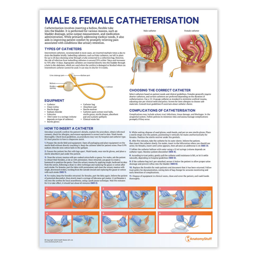 Male and Female Catheterisation Chart / Poster