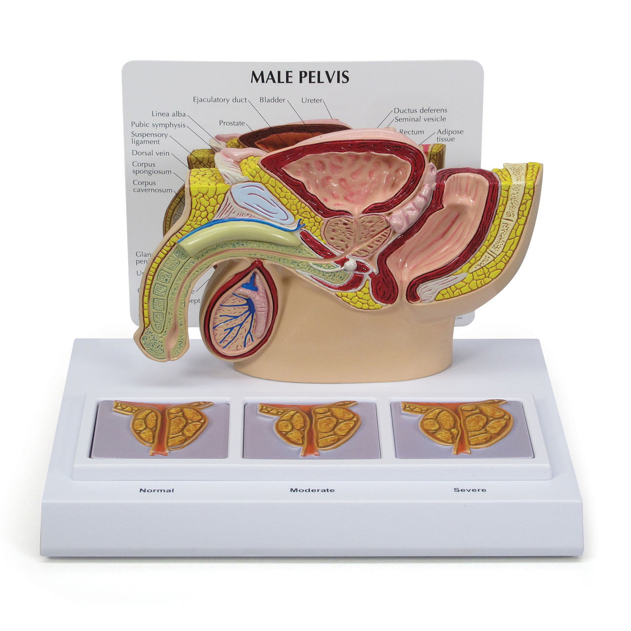 Male Reproductive System Anatomy & Pathology Collection