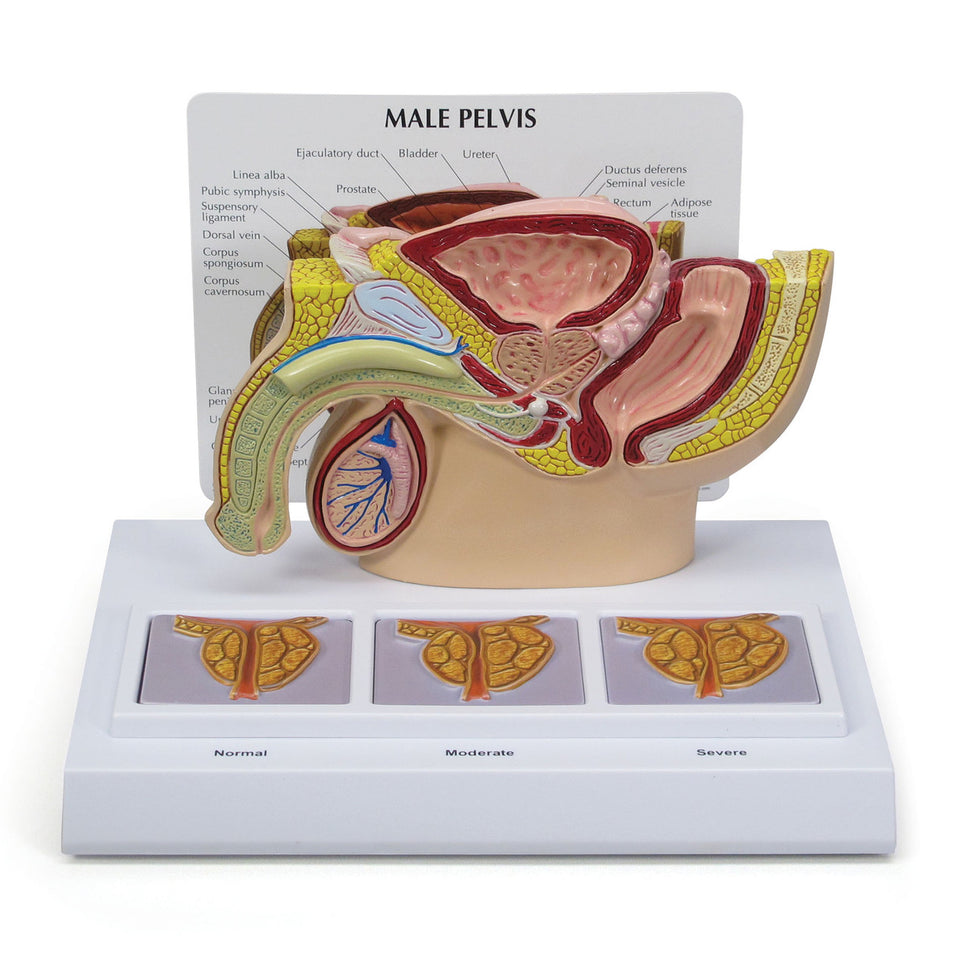 Male Reproductive System Anatomy & Pathology Collection