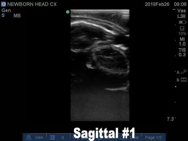 Newborn Head Phantom (Complex) for X-Ray CT, US, MRI