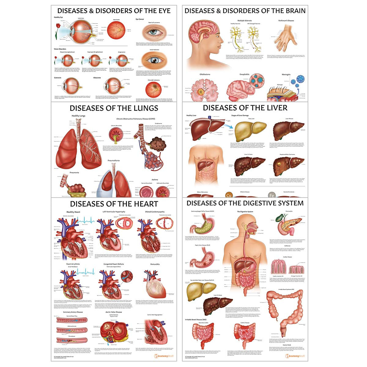 Organ Pathology 6 Poster Collection