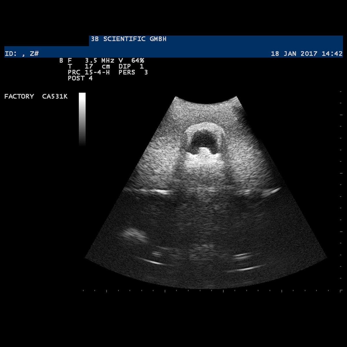 SONOtrain Ultrasound Vein Model