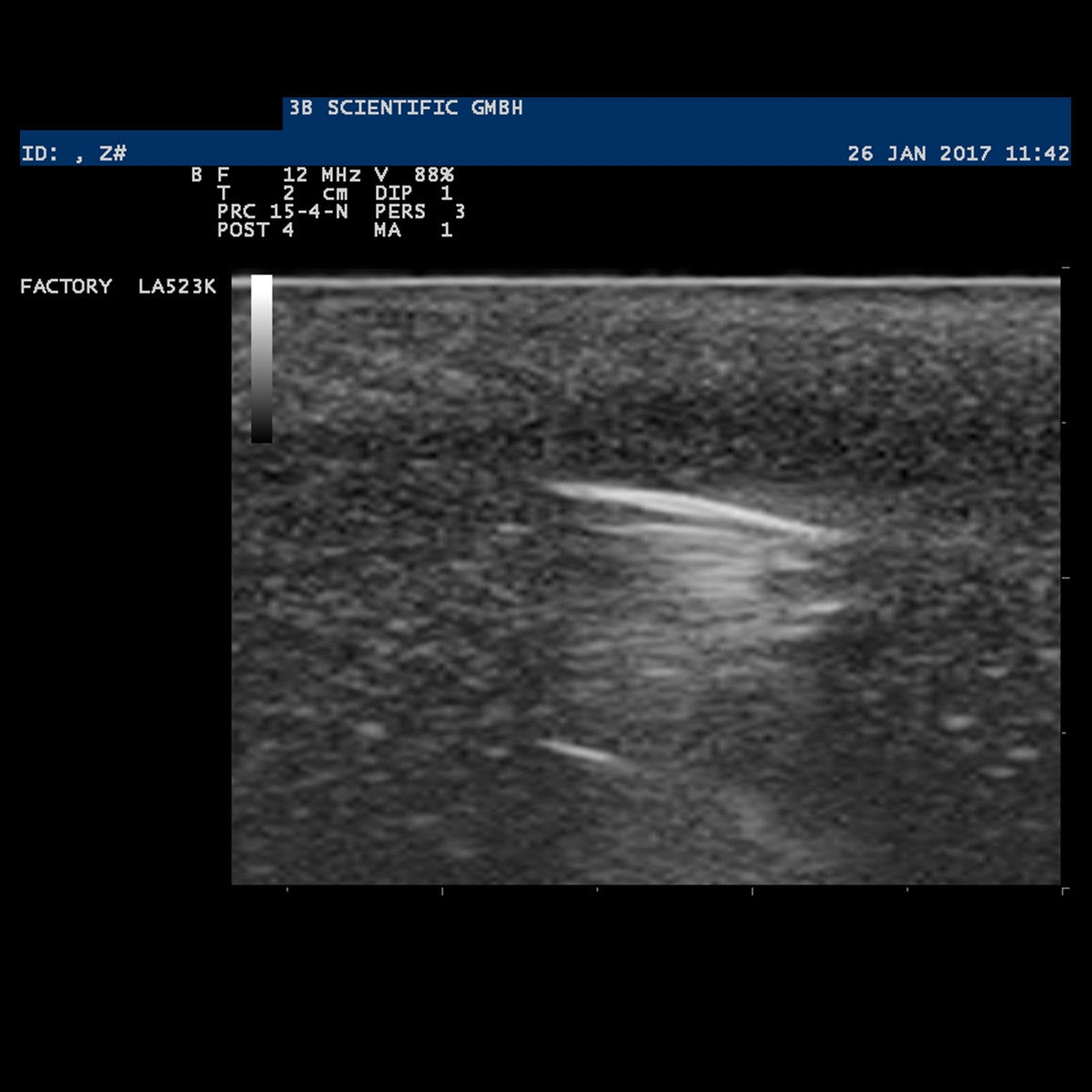 SONOtrain Ultrasound Foreign Body Model