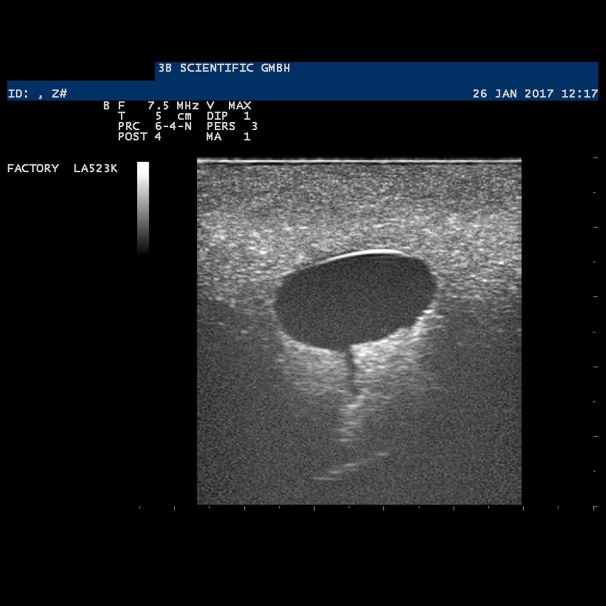 SONOtrain Ultrasound Breast Model with Cysts