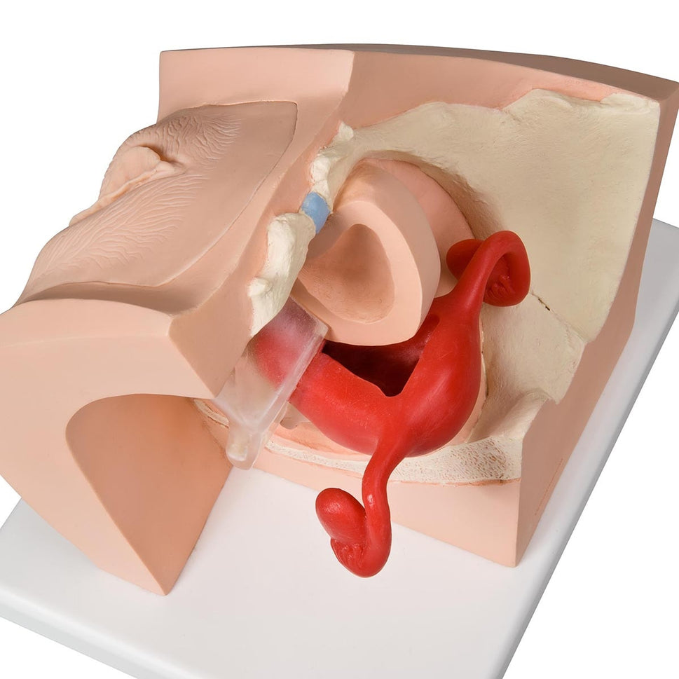 Gynaecological Patient Education Model