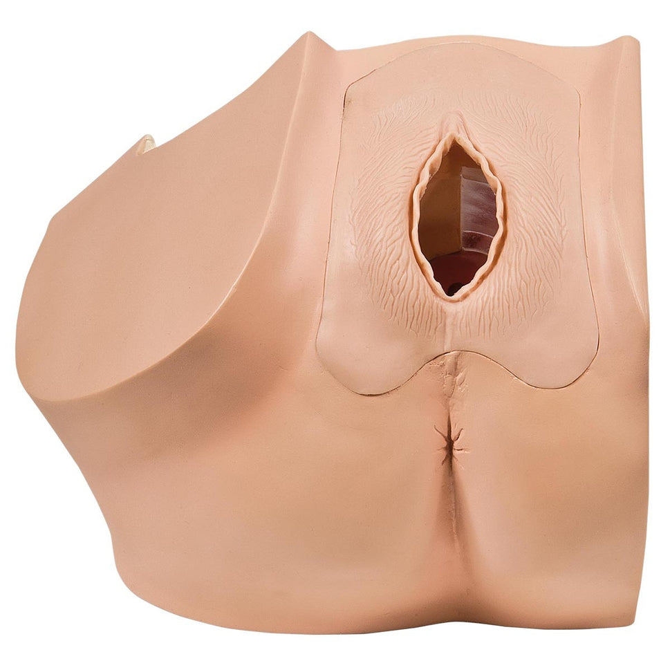 Gynaecological Patient Education Model
