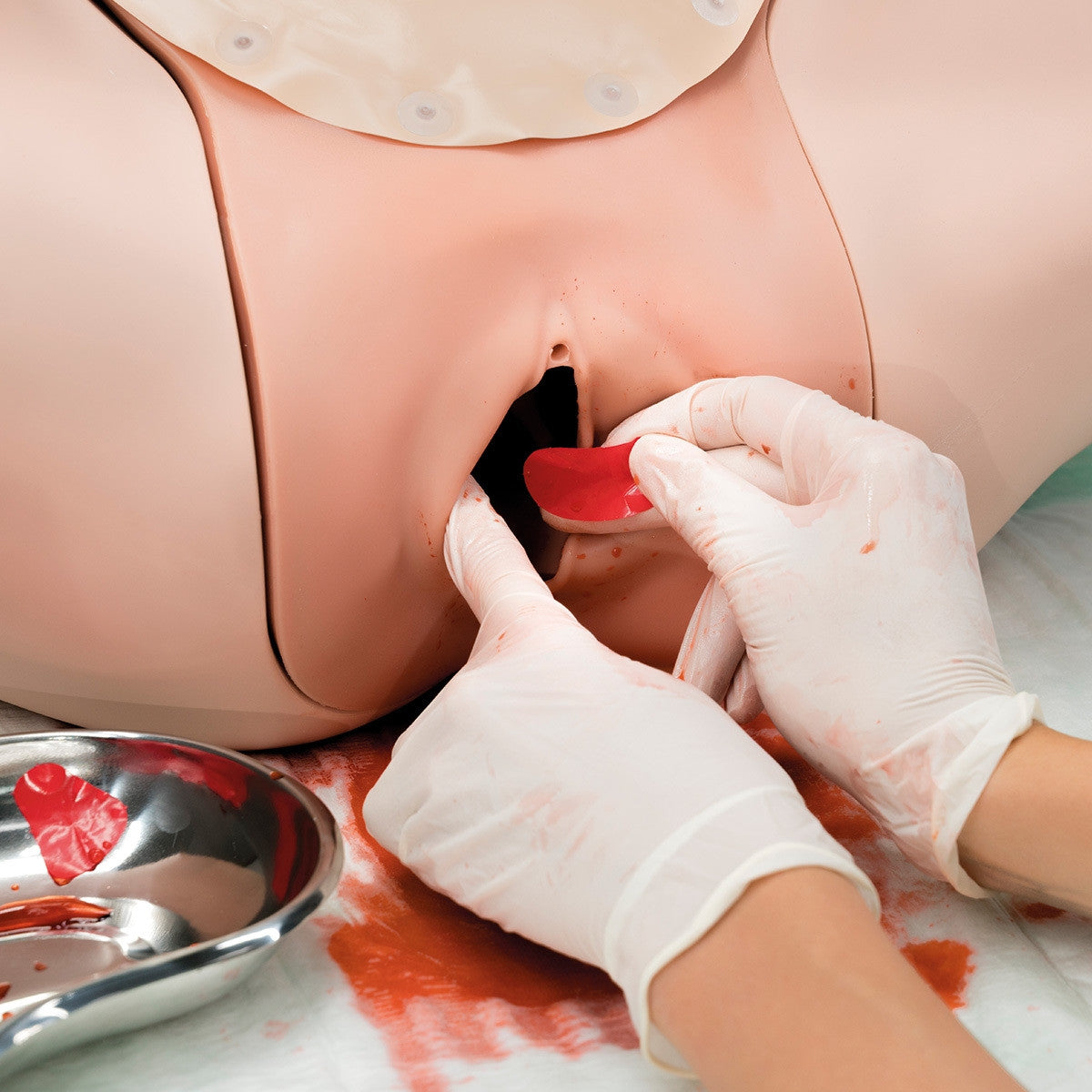Postpartum Hemorrhage (PPH) Trainer