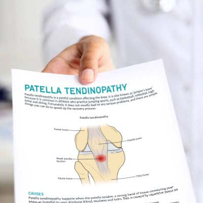 Patella Tendinopathy Patient Education Handout (Printable PDF)
