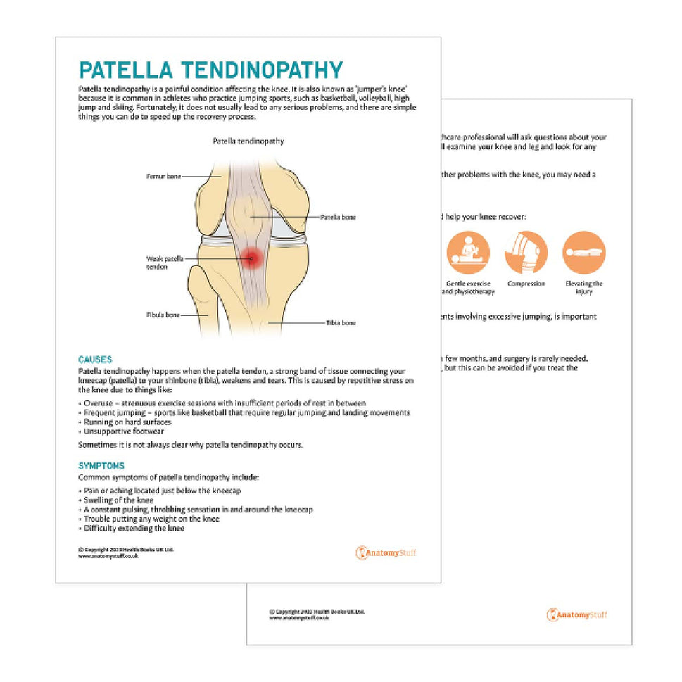 Patella Tendinopathy Patient Education Handout (Printable PDF)