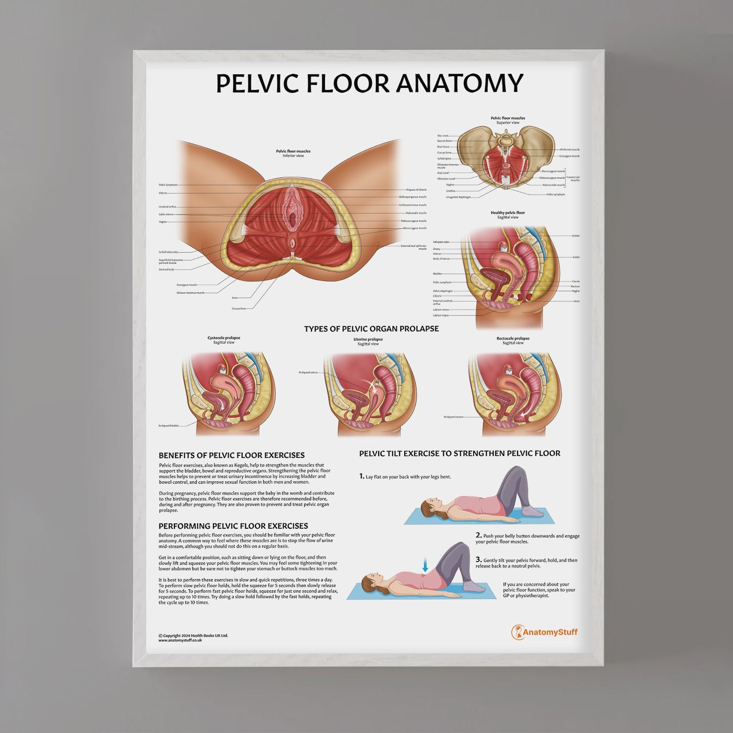 Pelvic Floor Anatomy Chart / Poster - Part of Collection