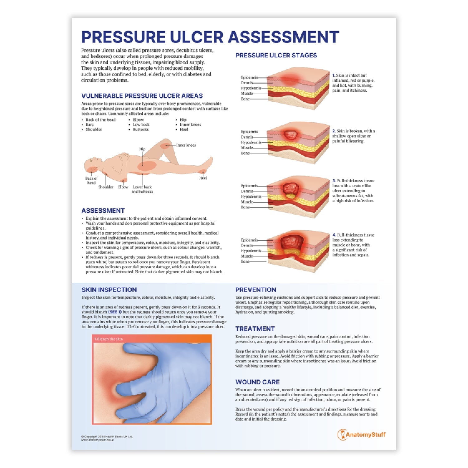 Pressure Ulcer Assessment and Care Chart / Poster - Part of Collection